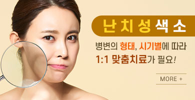 색소침착