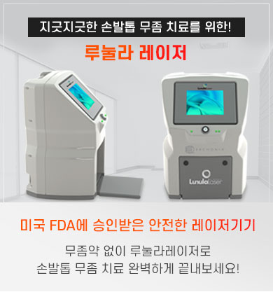 레이저장비
